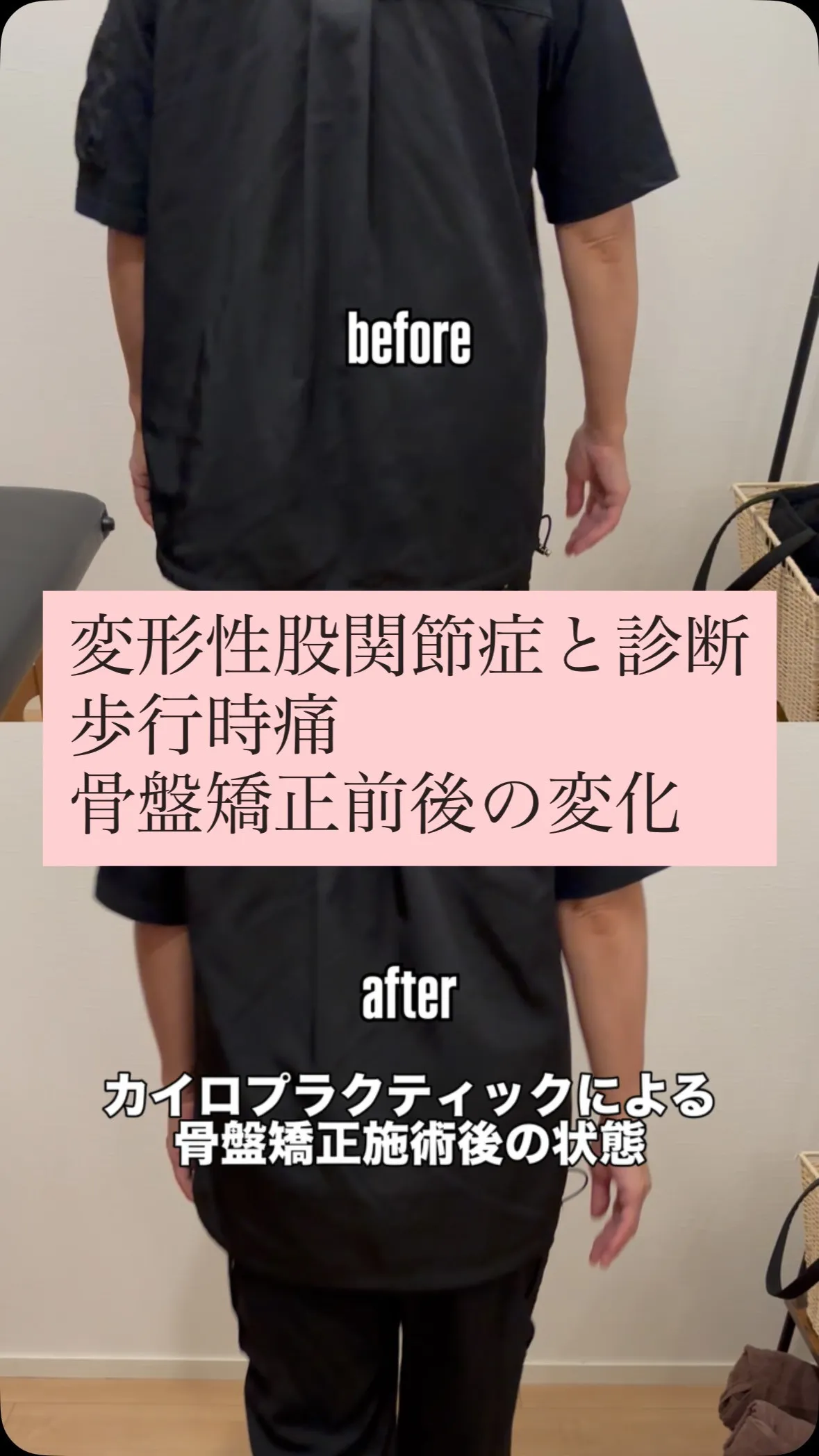 《盛岡|菜園|ZEN整体:変形性股関節症の痛み改善》