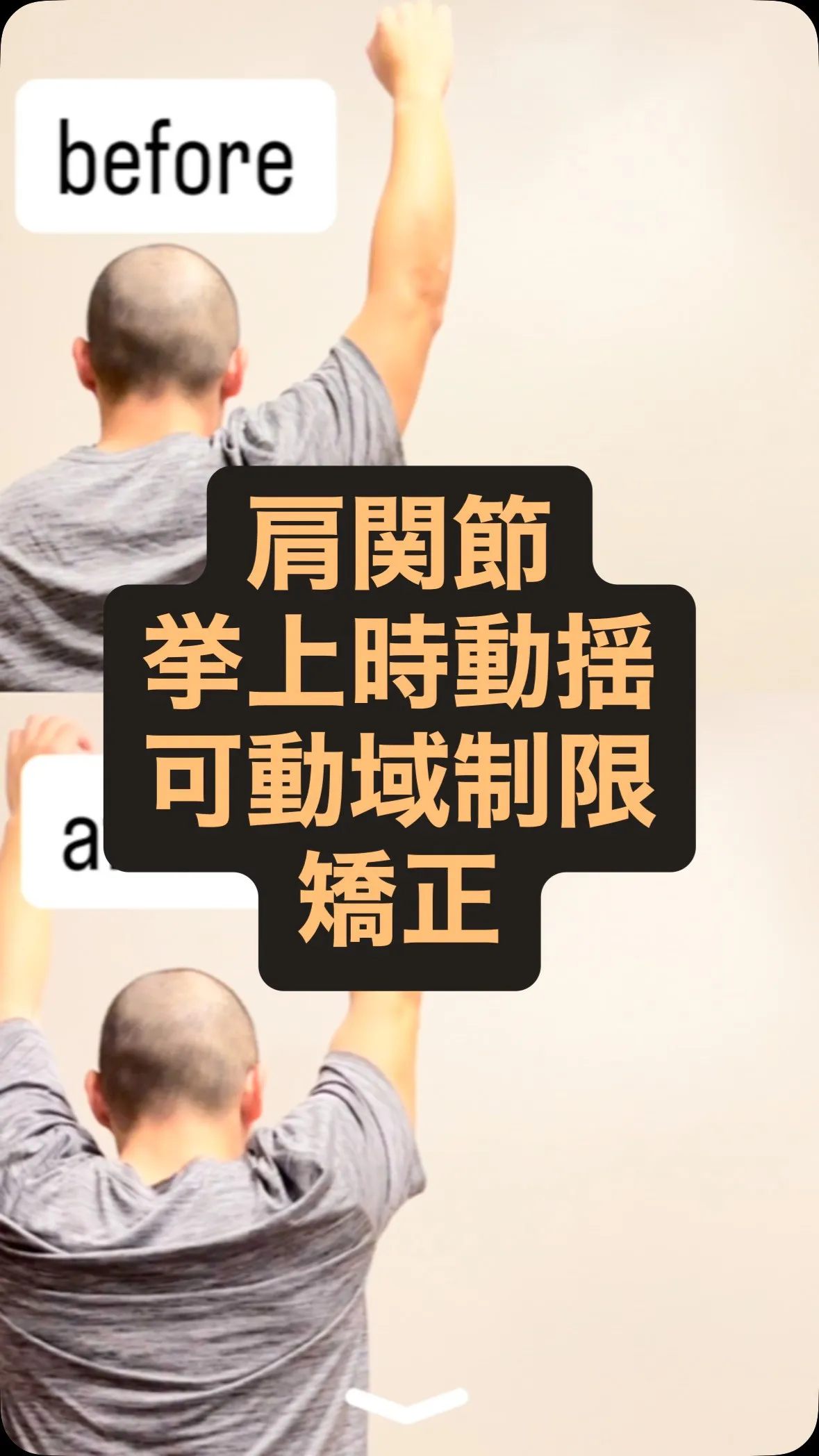 《盛岡|菜園|ZEN整体:肩関節矯正》